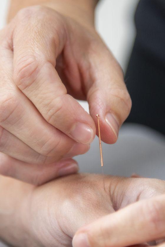 Physio Acupuncture